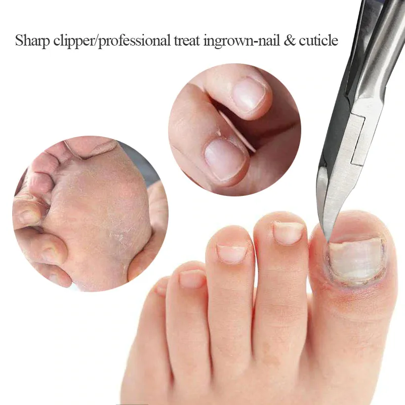 Precision Toenail Clippers